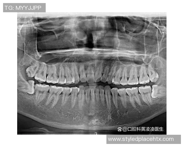 奇克遭遇牙槽骨骨折多颗牙齿脱落或将影响近期进食与讲话能力